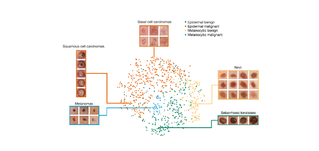 Machine Learning in Healthcare Classification of Cancer